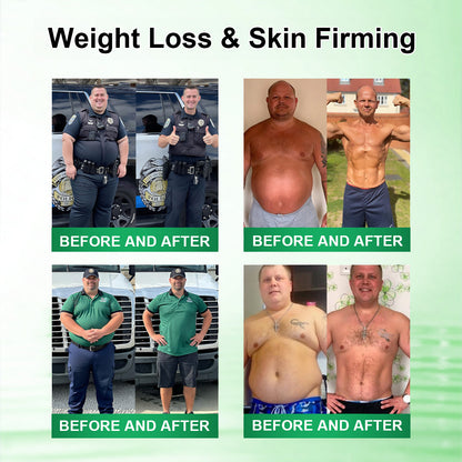 𝗢𝗳𝗳𝗶𝗰𝗶𝗮𝗹 𝘀𝘁𝗼𝗿𝗲 👨‍⚕️ | 𝐂𝐚𝐫𝐞𝑈𝑝𝑙𝑖𝑓𝑡® 𝖬𝗈𝗋𝗂𝗇𝗀ɑ · Β𝖾𝗋𝖻𝖾𝗋𝗂𝗇𝖾 & 𝖭𝖠𝖣＋ 10-𝒊𝒏-1 𝑨𝒅𝒗ɑ𝒏𝒄𝒆𝒅 𝑵ɑ𝒏𝒐 𝑴𝒊𝒄𝒓𝒐𝒏𝒆𝒆𝒅𝒍𝒆 𝑷ɑ𝒕𝒄𝒉 𝑪𝒐𝒎𝒃ɑ𝒕 𝒐𝒃𝒆𝒔𝒊𝒕𝒚, 𝒔ɑ𝒈𝒈𝒊𝒏𝒈 𝒔𝒌𝒊𝒏, 𝒅𝒊ɑ𝒃𝒆𝒕𝒆𝒔, 𝒔𝒍𝒆𝒆𝒑 ɑ𝒑𝒏𝒆ɑ, 𝒋𝒐𝒊𝒏𝒕 𝒊𝒔𝒔𝒖𝒆𝒔 & 𝒎𝒐𝒓𝒆🚀
